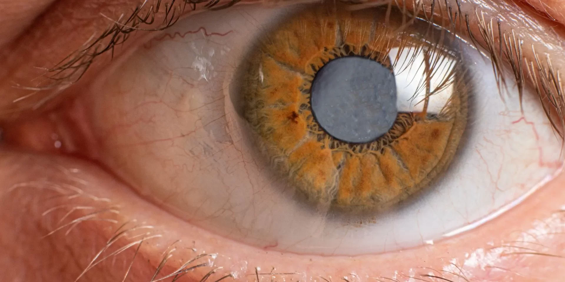 Benefici-di-luteina-e-zeaxantina-nella-cataratta