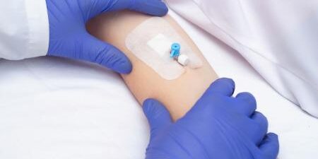 Coagulopatia come prodromo della tempesta di citochine nei pazienti infetti da Covid-19 (SARS-CoV-2)