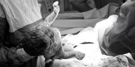 Una revisione sistematica evidenzia l&rsquo;associazione tra parto pretermine e microbioma vaginale