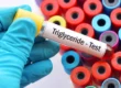 Olio di spore di Ganoderma lucidum in capsule softgel, integratore studiato per il controllo dei trigliceridi e del colesterolo