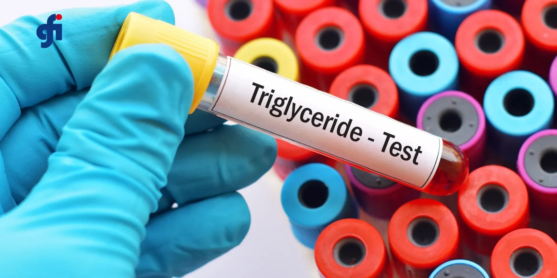 Olio di spore di Ganoderma lucidum in capsule softgel, integratore studiato per il controllo dei trigliceridi e del colesterolo
