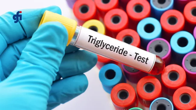 Olio di spore di Ganoderma lucidum in capsule softgel, integratore studiato per il controllo dei trigliceridi e del colesterolo