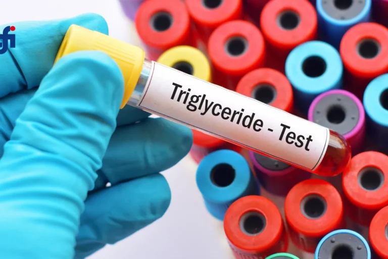 Olio di spore di Ganoderma lucidum in capsule softgel, integratore studiato per il controllo dei trigliceridi e del colesterolo
